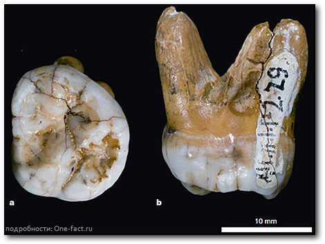 Зуб денисова человека, найденный на Алтае. Больше всего денисовских генов сейчас обнаруживаются у жителей Меланезии. В геном же европейцев, они скорее всего попали через посредничество неандертальцев.